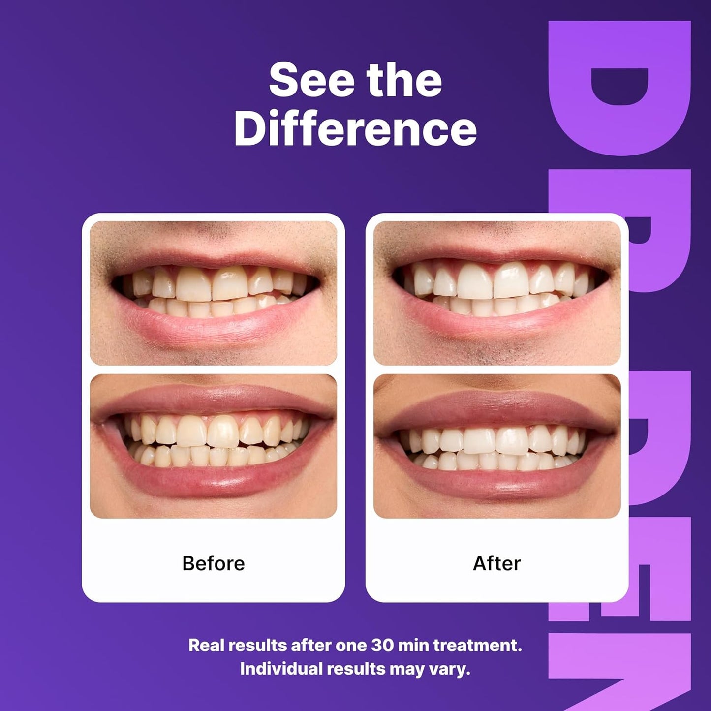 Purple Teeth Whitening Strips 21 Treatments - Safe for Enamel - Non Sensitive Teeth Whitening - Whitening without Any Harm - Pack of 42 Strips